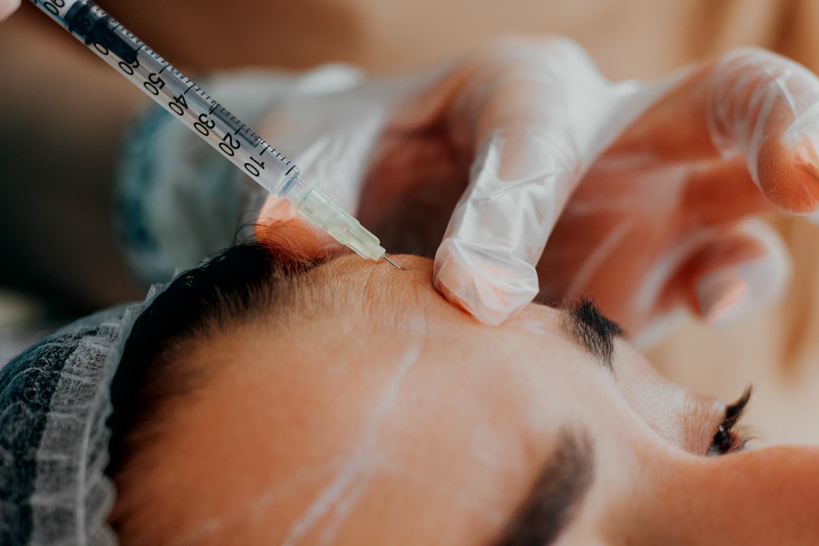 Botox vs. Dysport: What to Ask Before Wrinkle Treatment