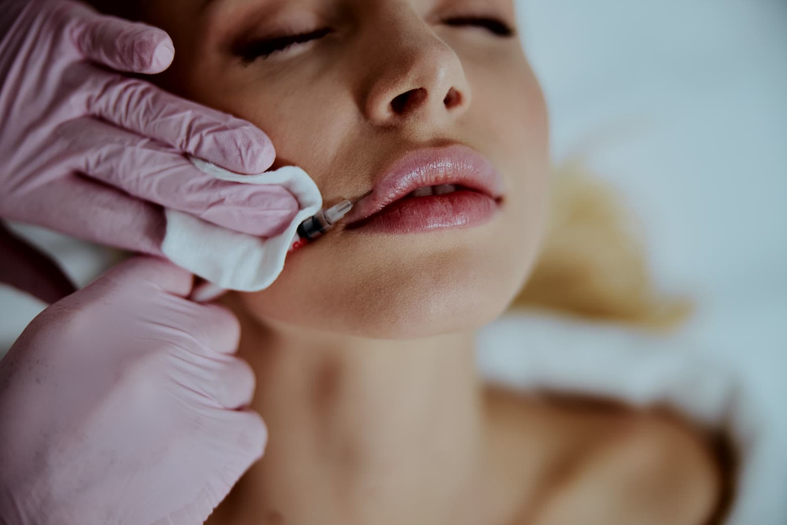 Dermal Fillers treatment at JW Holland Wellness